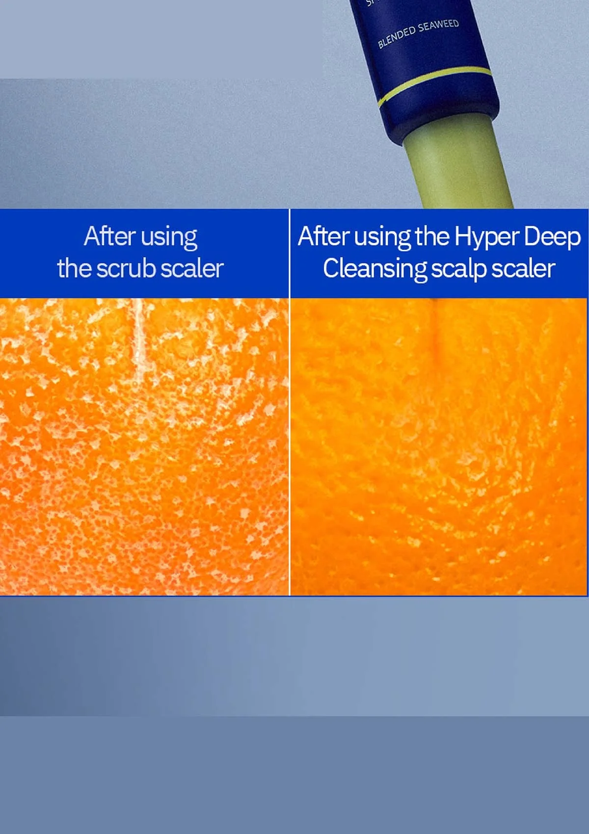 [FORBEAUT] Hyper Deep Cleansing Scalp Scaler (1 Box = 15g x 4pcs) - Image 15