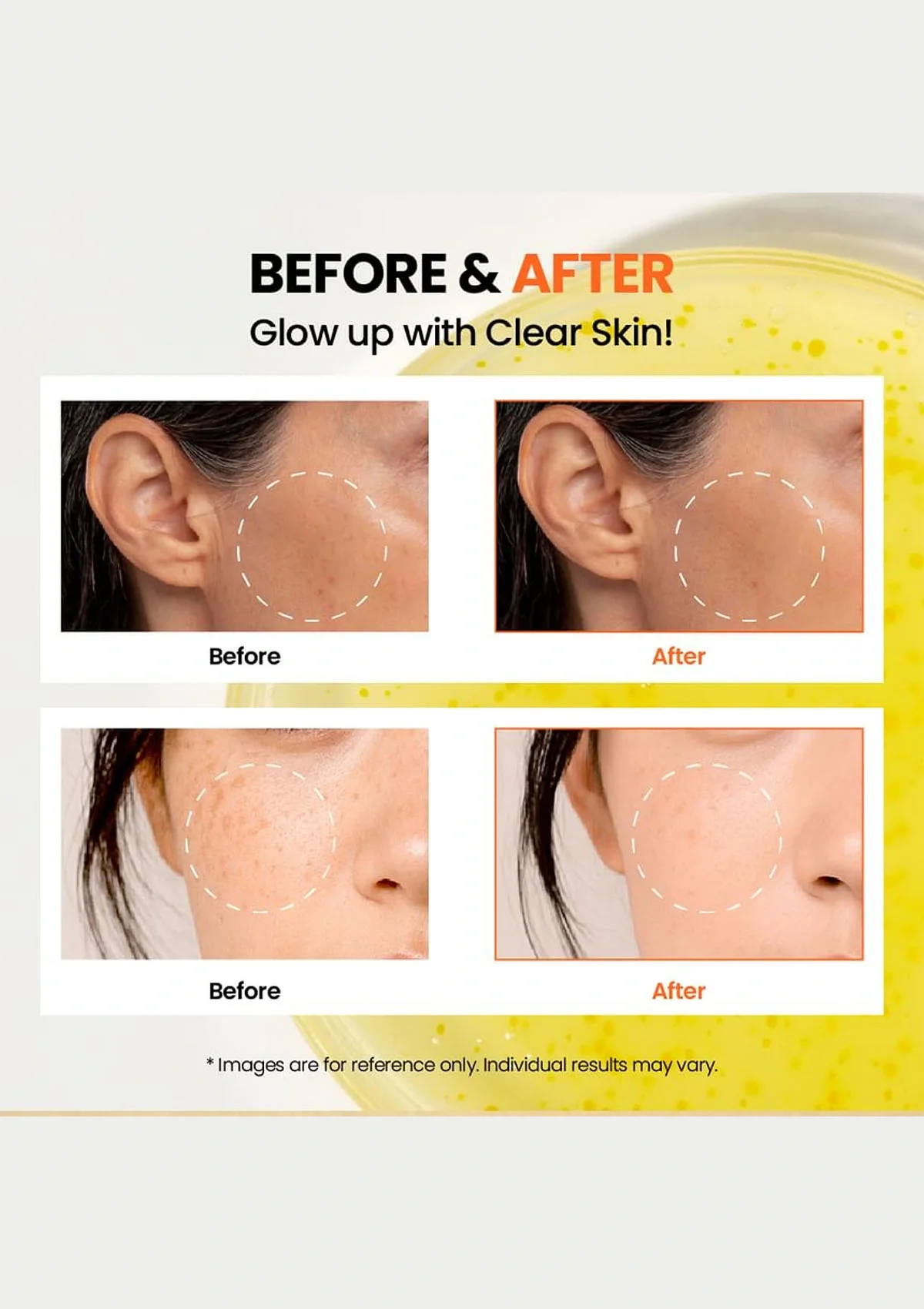 [K-SECRET] Niacinamide 15% + Yuja Serum 30 ml - Image 8