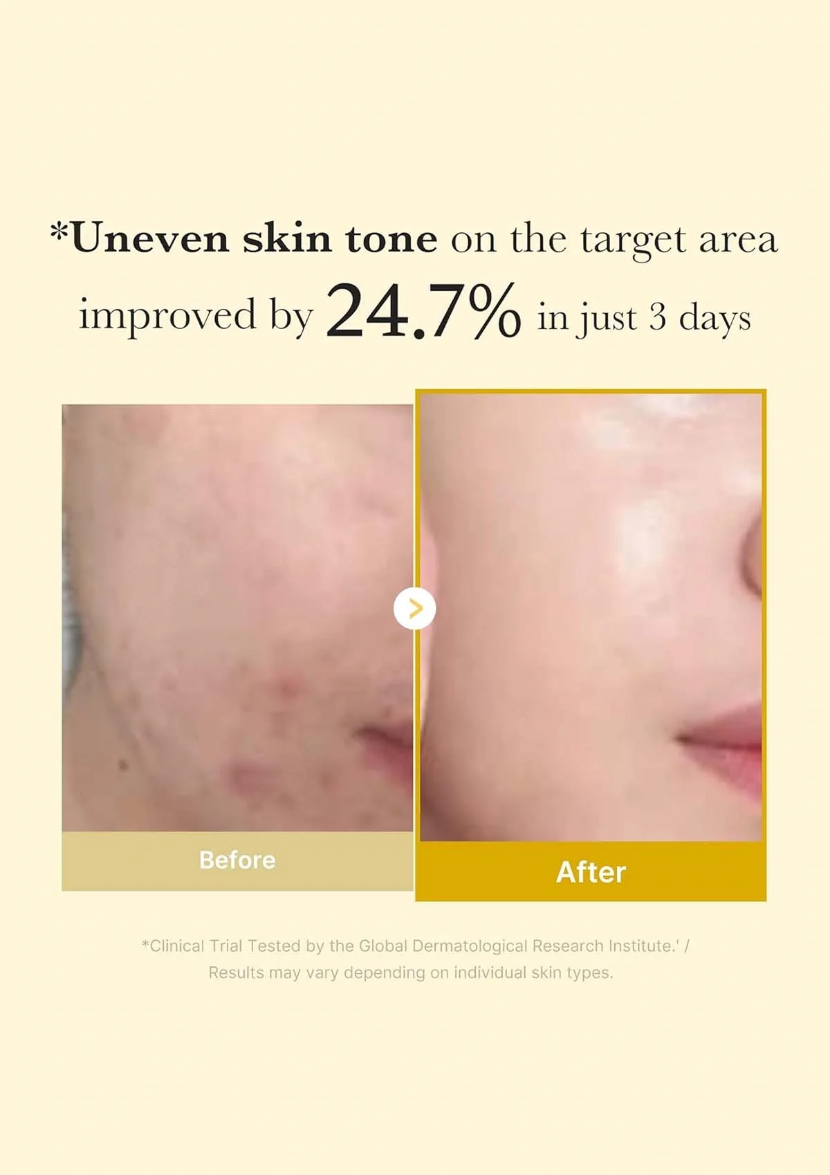 [MEDICUBE] Kojic Acid Turmeric Night Wrapping Mask 75ml - Image 6
