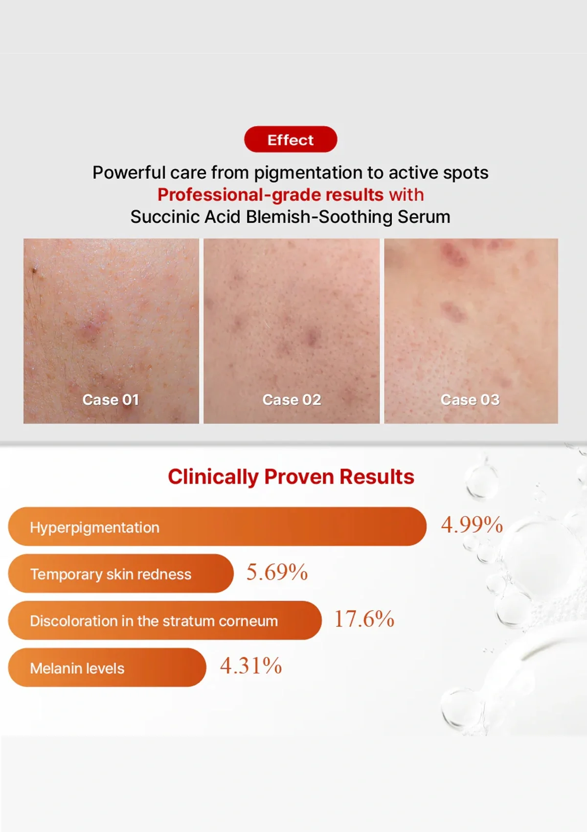 [MEDICUBE] Red Succinic Acid Serum 30ml - Image 7