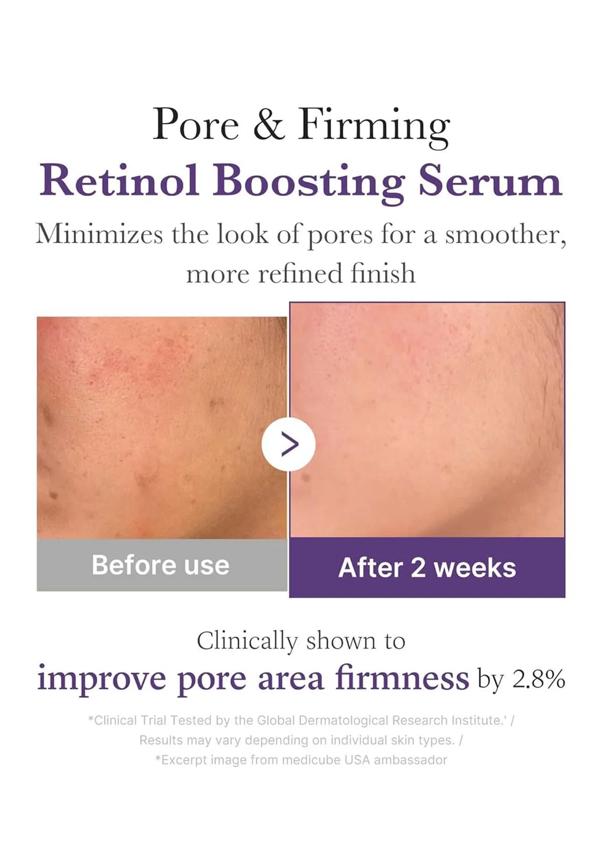 [MEDICUBE] Retinol NMN Boosting Serum 30ml - Image 4