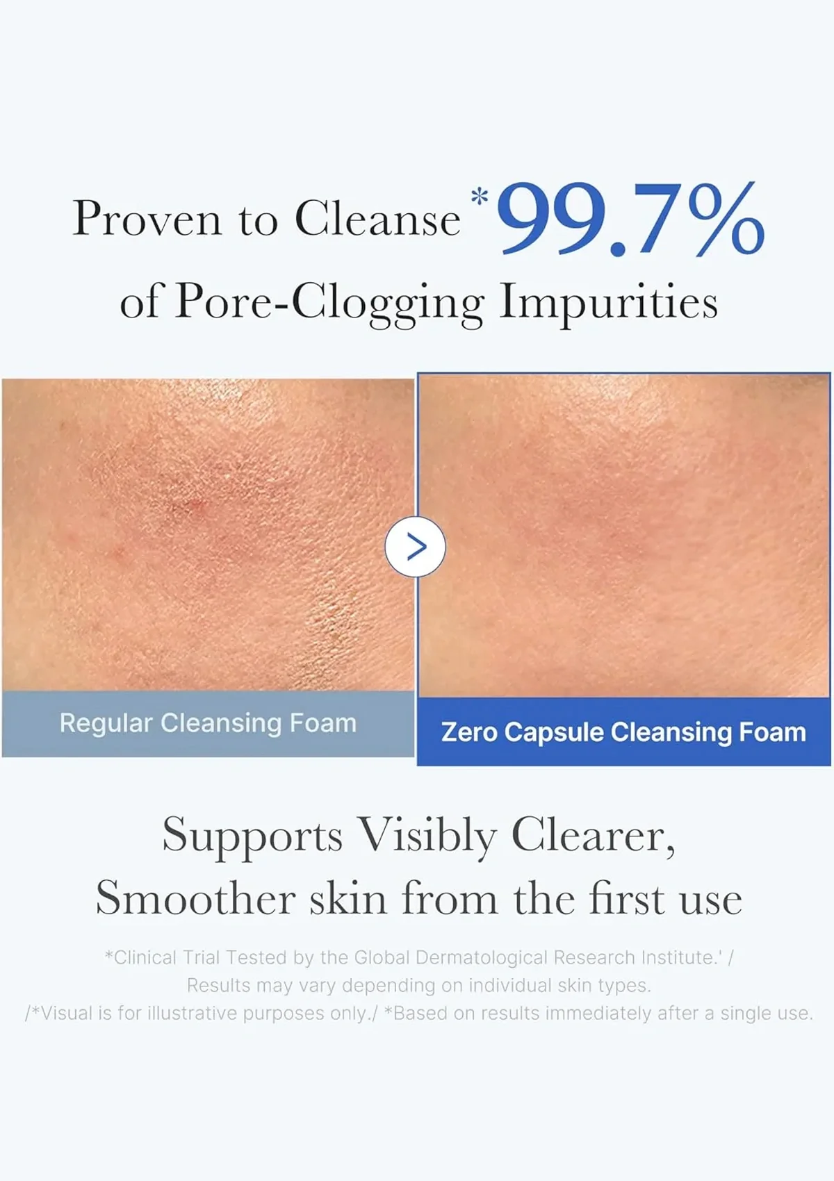 [MEDICUBE] Zero Pore SA Clear Capsule Cleansing Foam 120g - Image 7