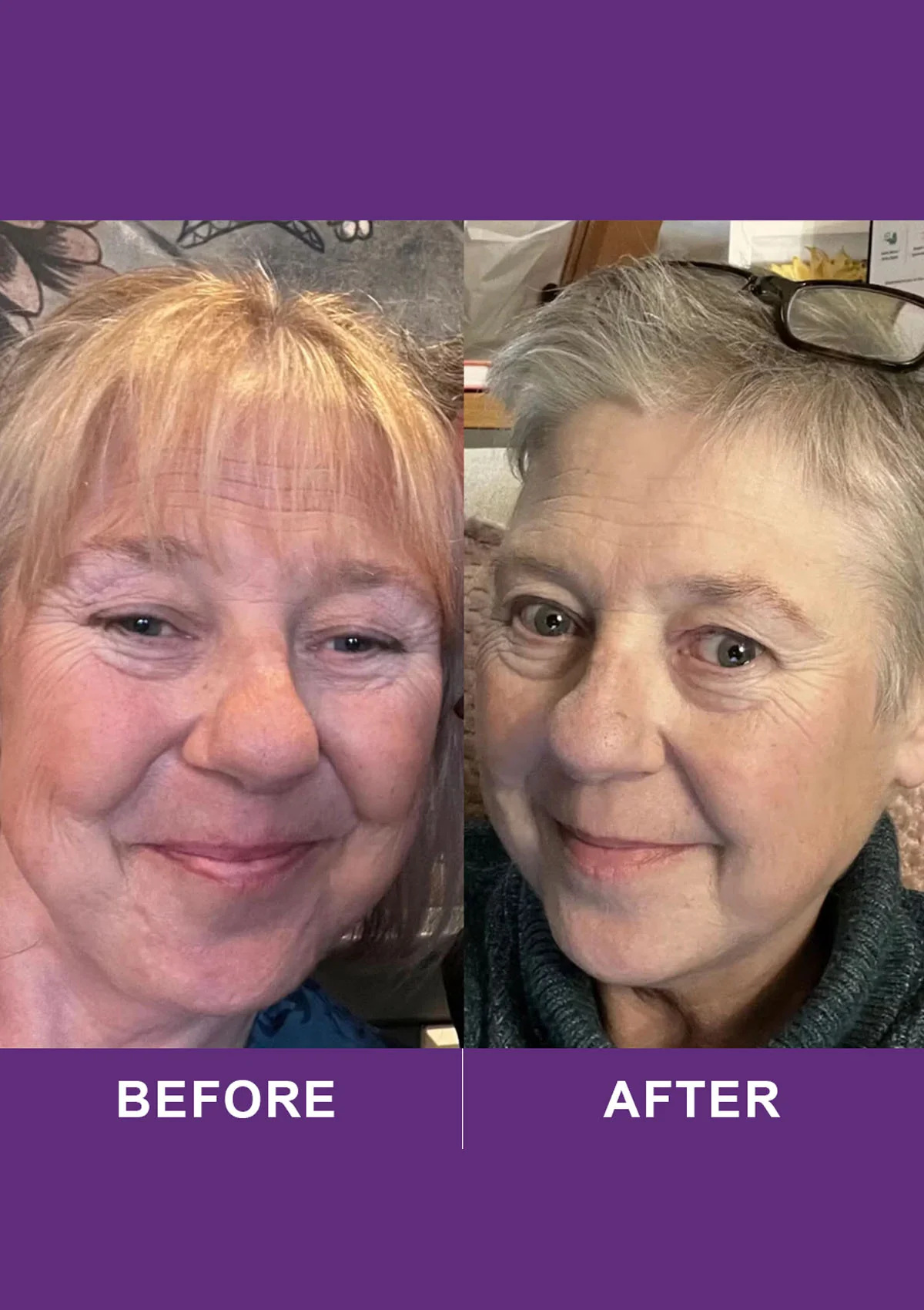 Revive Collagen Menopause Max - 10000mg Type 1 Hydrolysed Marine Collagen Drink - Image 4