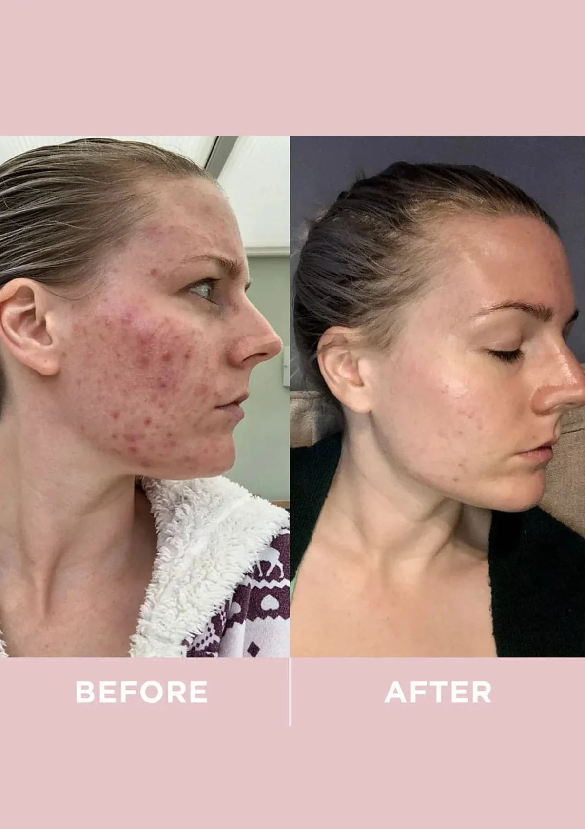 Revive Collagen Original - 8500mg Type 1 Hydrolysed Marine Collagen Drink - Image 6