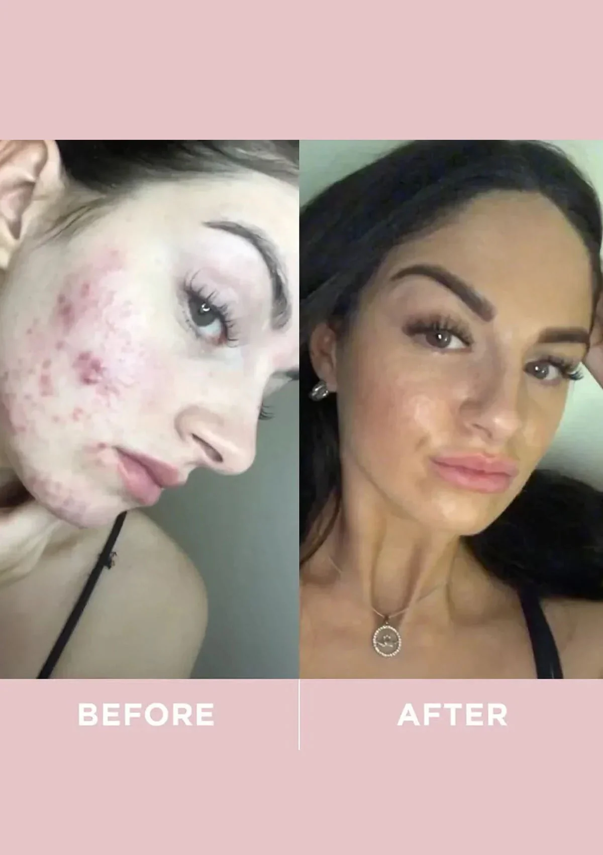 Revive Collagen Original - 8500mg Type 1 Hydrolysed Marine Collagen Drink - Image 7