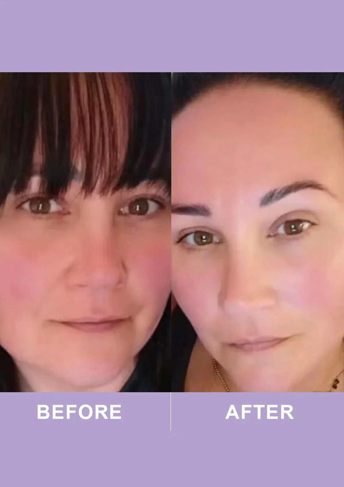 Revive Collagen Peri Menopause - 5000mg Type I Hydrolysed Marine Collagen Drink - Image 3