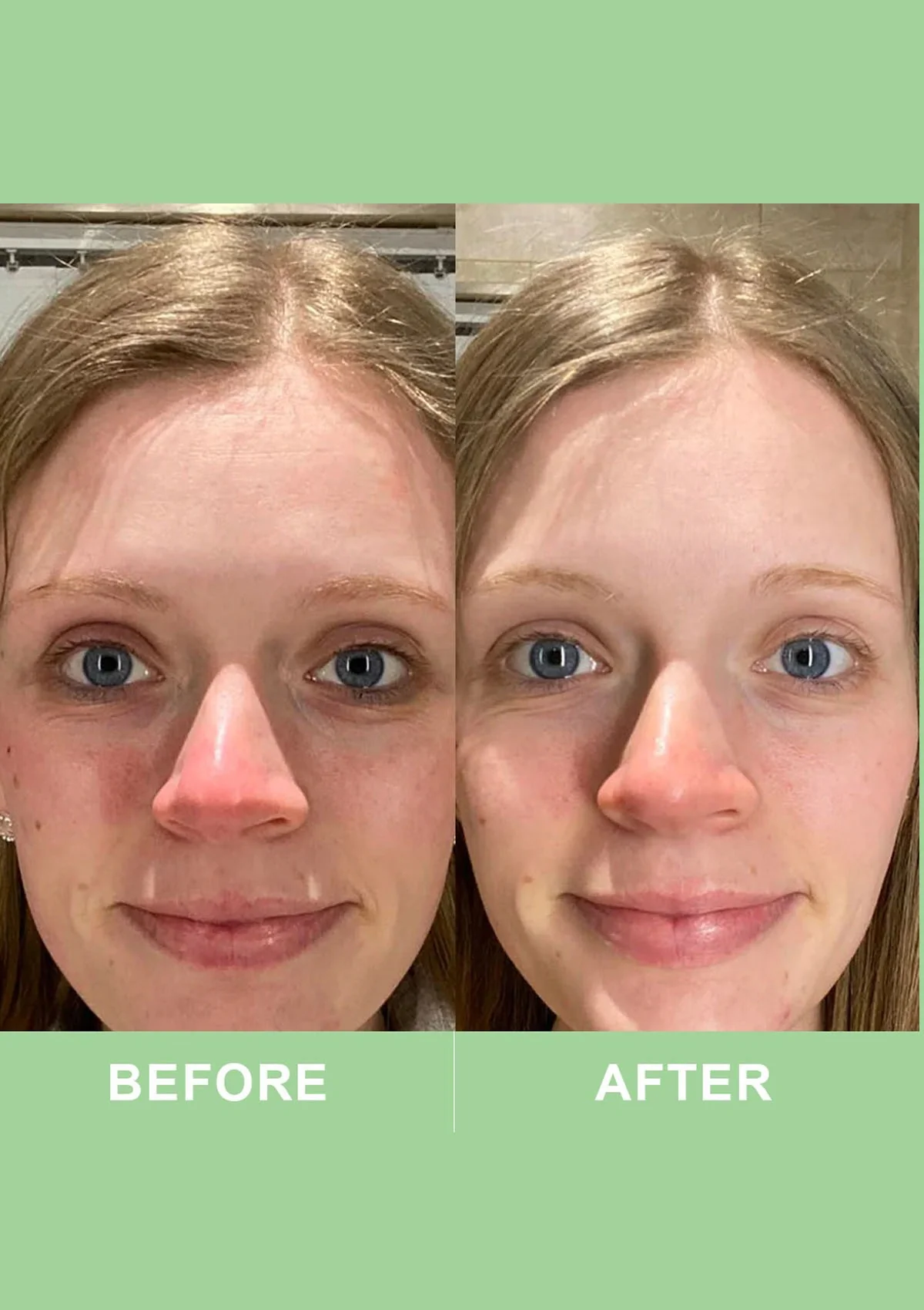 Revive Collagen Vegan - The World's First Clinically Proven Vegan Collagen - Image 4