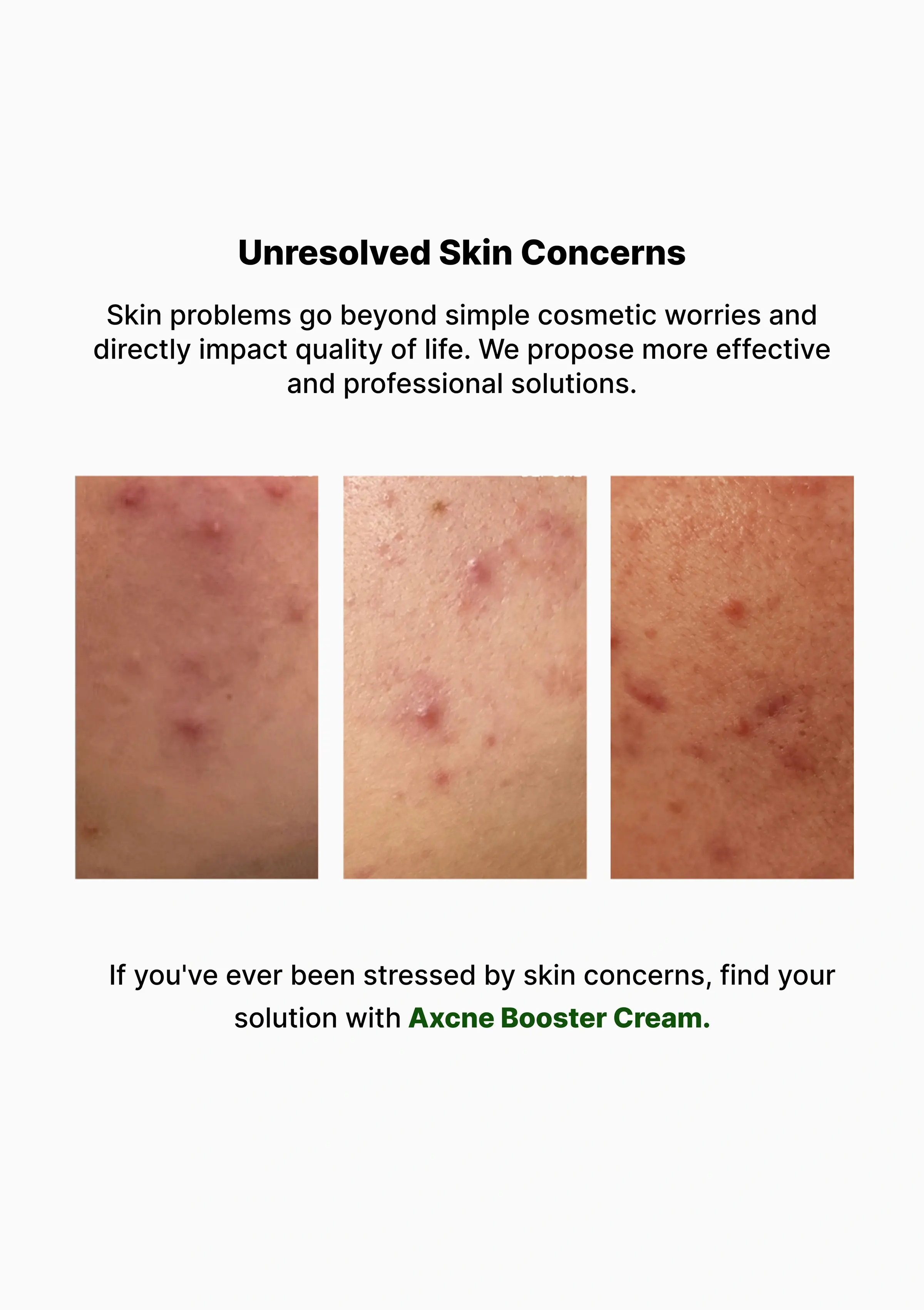[VEMONTES] Axcne Booster Cream 25ml | 50ml - Image 4