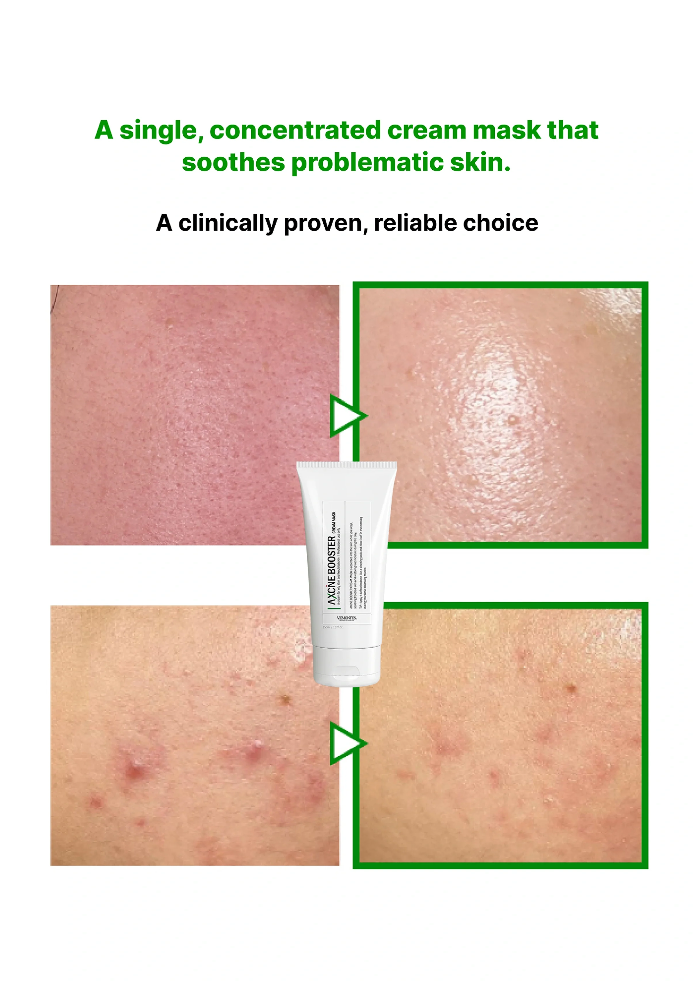 [VEMONTES] Axcne Booster Cream Mask 150ml - Image 12