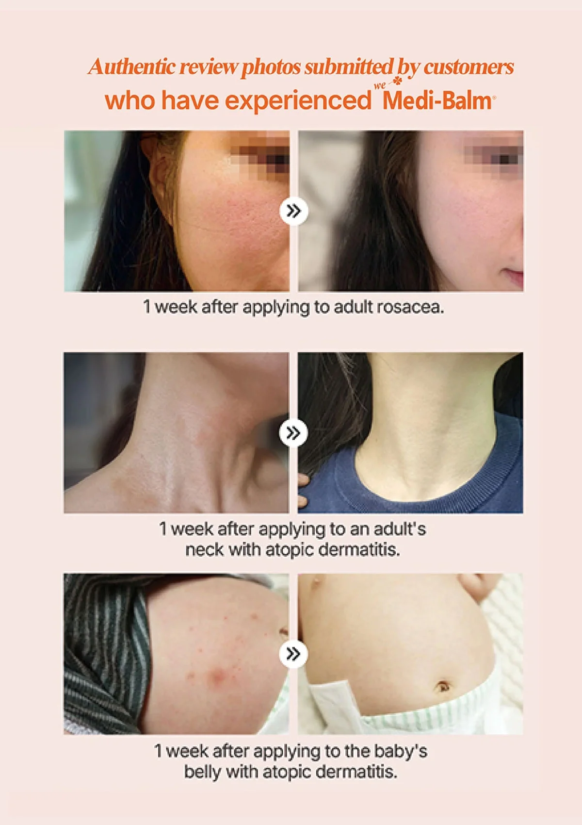 [WE MEDI BALM] Astaxanthin Multi Skin Care Balm 20g - Image 10