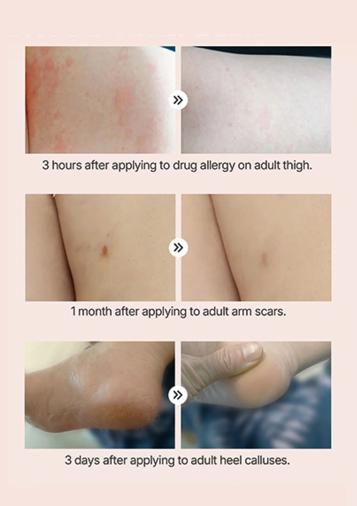 [WE MEDI BALM] Astaxanthin Multi Skin Care Balm 20g - Image 13