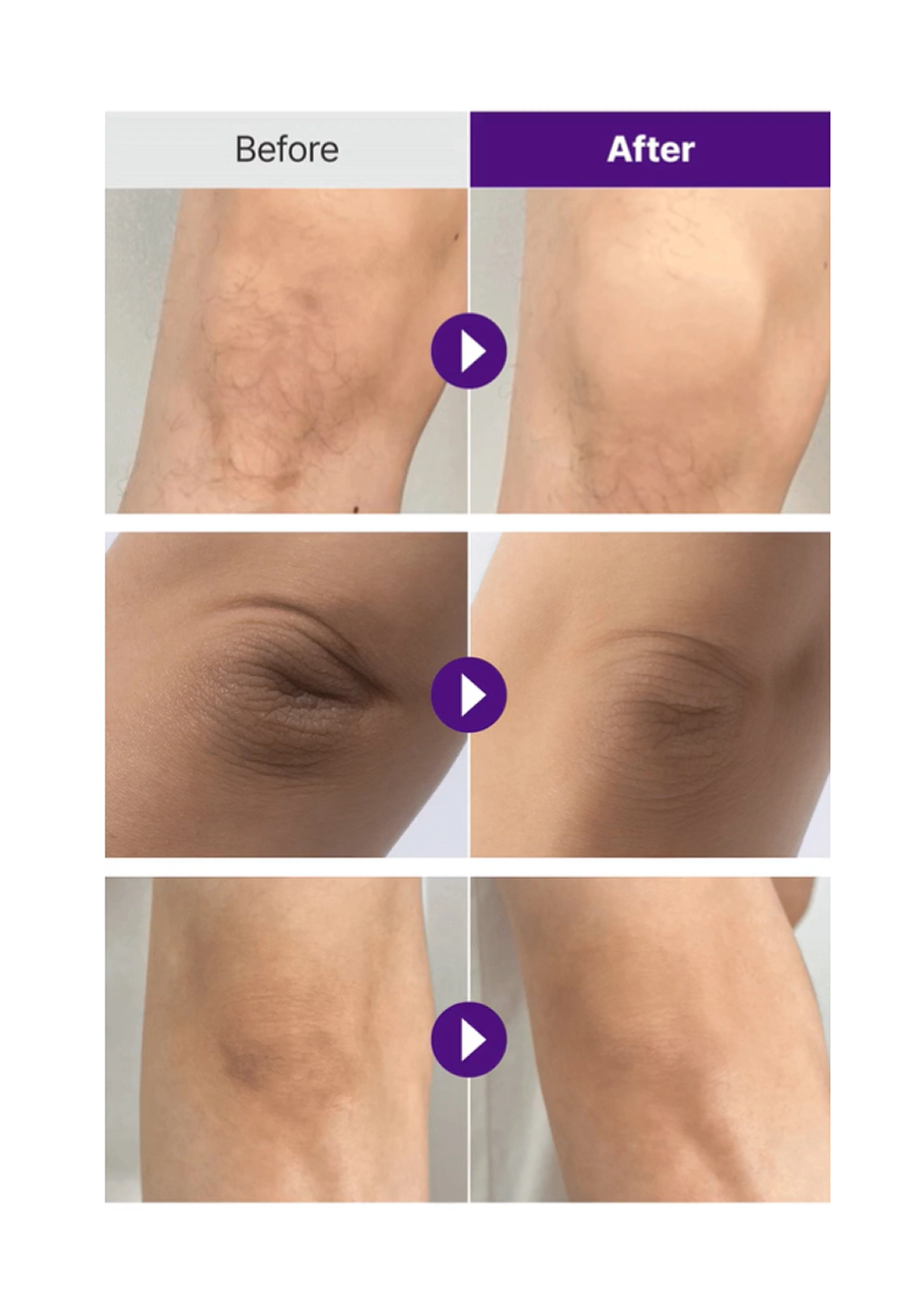 [YTNING]  Scaling Toning Scrub Wash 250ml - Image 5