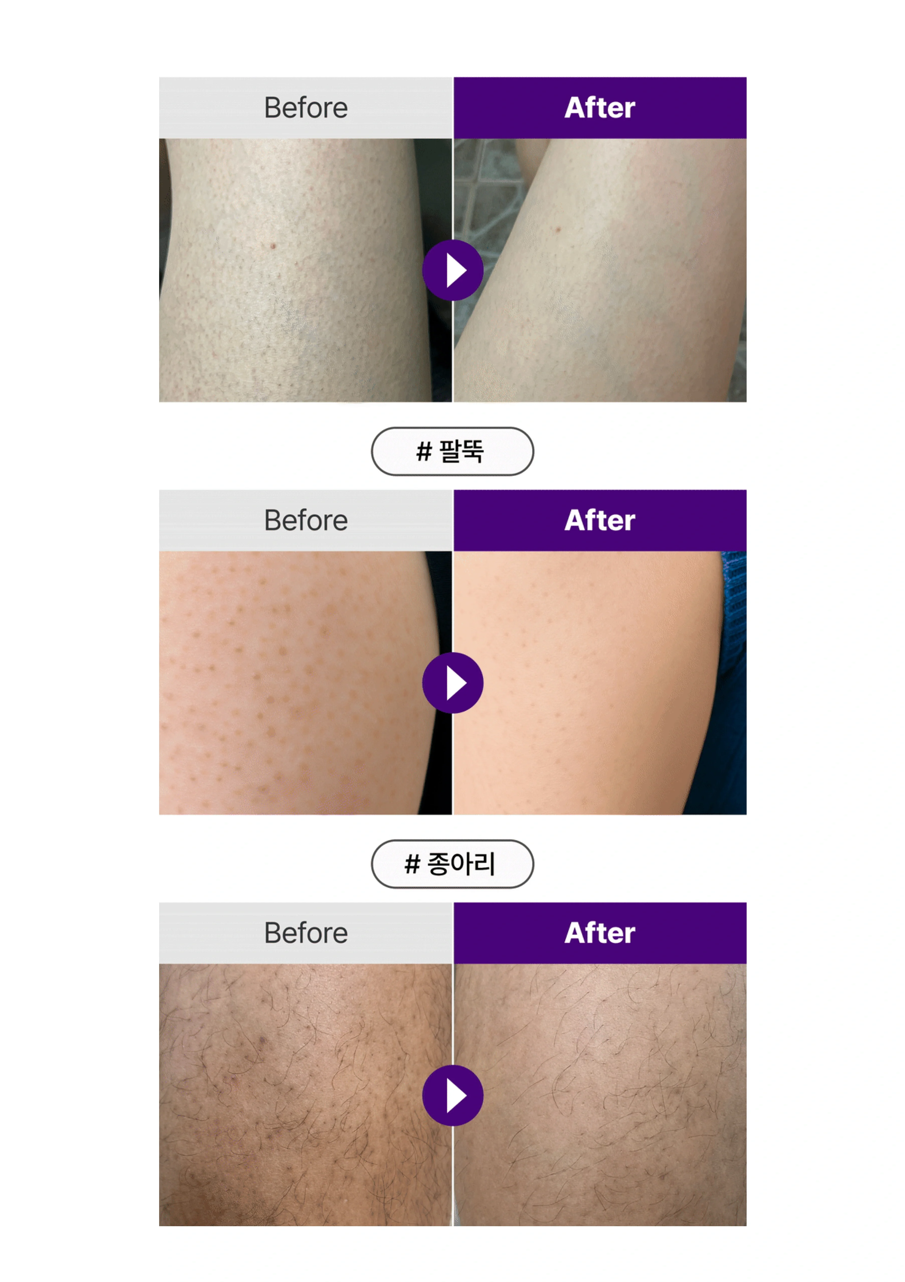 [YTNING]  Scaling Toning Scrub Wash 250ml - Image 7