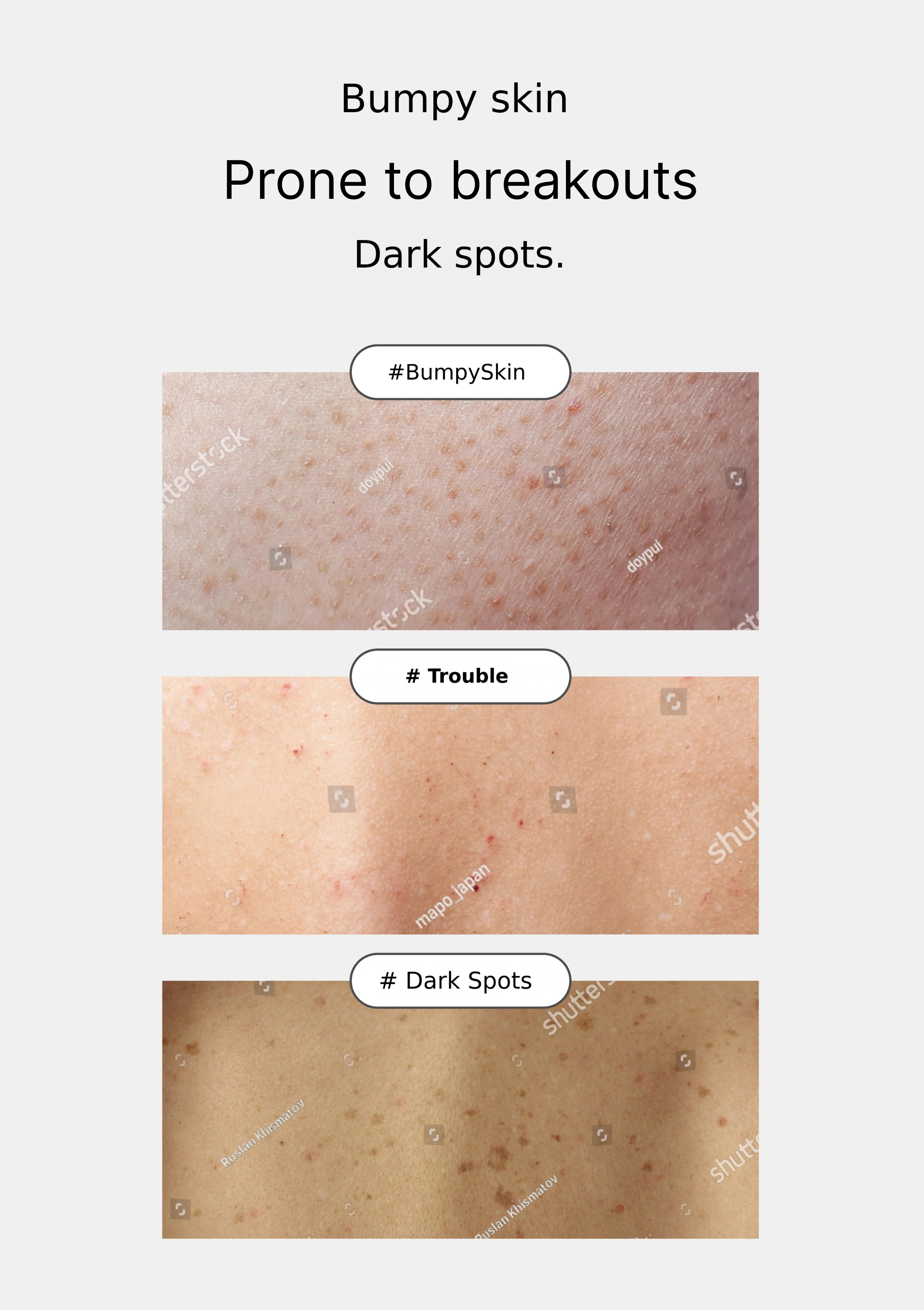 [YTNING]  Scaling Toning Scrub Wash 250ml - Image 9